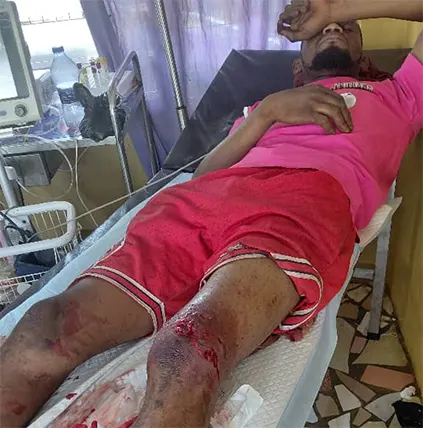 Suspected diesel thief shot, hospitalised in Ashanti Region