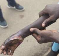 Police Officer burnt boy hand over GHC2