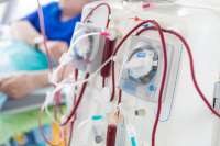 Dialysis patients: Association appeals to government to save them  from dying