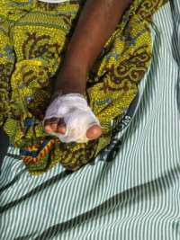 Woman detained for allegedly cutting daughter’s toe with scissors at Juaboso
