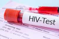 Ghana recorded 17,774 new HIV infections in 2023 —AIDS Commission