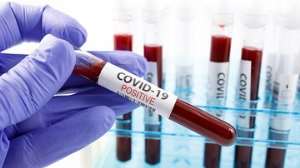 COVID-19: Ghana’s Active Cases Rise To 831