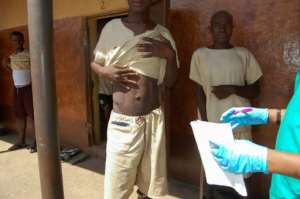 A prisoner shows signs of skin disease to a health worker at Mafanta prison. Prisoners in Sierra Leone jails say their cells are often overrun with rats, cockroaches and bedbugs.  By Saidu BAH (AFP)