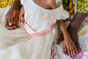 Doctors in the Kasai often treat children who have been reduced to virtual skeletons by malnutrition.  By Arsene Mpiana (AFP)