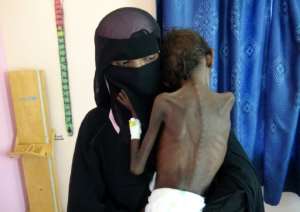 UN has described Yemen as the worlds worst humanitarian disaster.  By - (AFP/File)