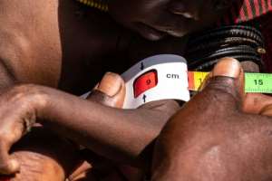 Across the region, over 90,000 children are suffering from acute malnutrition. By Badru KATUMBA AFP