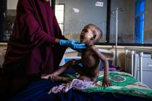 Aid agencies have raised less than 20 percent of the funds needed to prevent a famine. By Ed RAM AFP