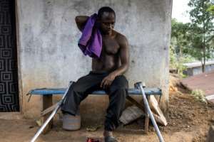 Sheku Turay was just 12 when rebels attacked his village, leading to him losing his leg. By JOHN WESSELS AFP