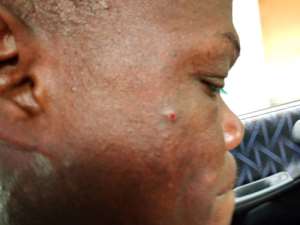 Journalists Assaulted By Somanya Police