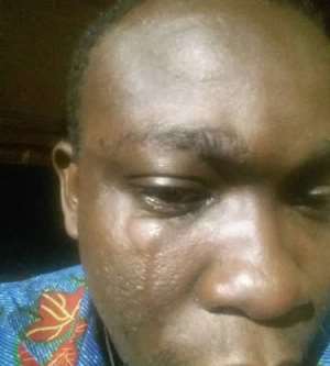 Journalist Suffers Eye Infection After Assault By Mahama Security