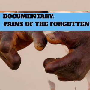 Pains of the Forgotten: Leprosy, Stigma, and Resilience in Ghana