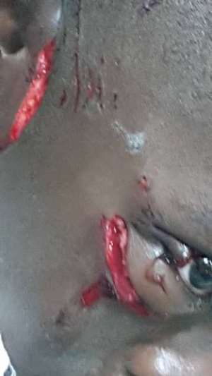 Dog Bites 5 Persons
