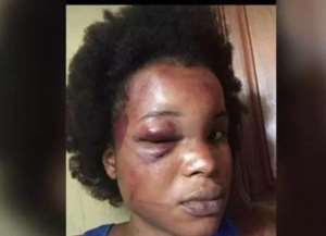 Benedicta Gafah Explains Why She Was Brutally Battered By Sugar Daddy