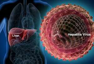 Human liver infected with Hepatitis-B