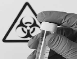 The Threat Of Biological Weapons:  Putin Shows Concern While Africa Is Quiet