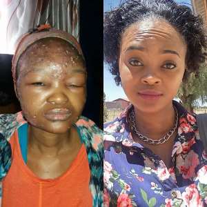 Photo - Kelebogile Masisi, before and now