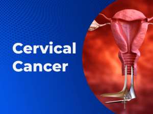 Cervical Cancer: Meeting Who Goals In Ghana-Are We Making Progress?