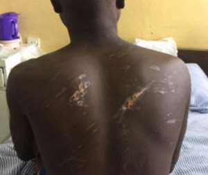 Soldier Brutality: CHRAJ Demands 30k Compensation For 16-Year-Old Boy