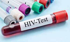 HIV cases on the rise; 33,870 tested positive from January to September in 2022 — NACP