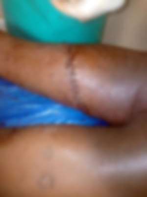 Twifo Praso: Delta security man arrested for slashing thigh of teenage boy with cutlass