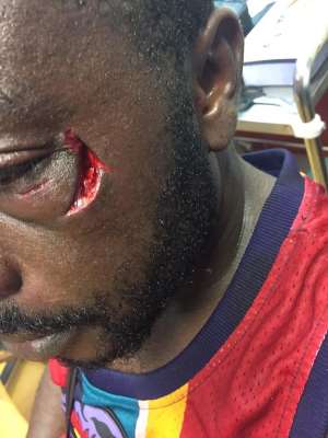 Ghanaian Boxer Patrick Allotey Beat Up Kotoko Supporter During Hearts Match
