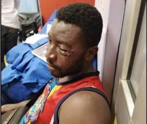 Assaulted Football Fan Denies Provoking Boxer Patrick Allotey