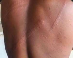 North East Regional Correspondent of Media General, Solomon Kwame Kanaluwe attacked by military