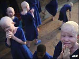 Albinism is a health condition in which a person has little or no skin pigment