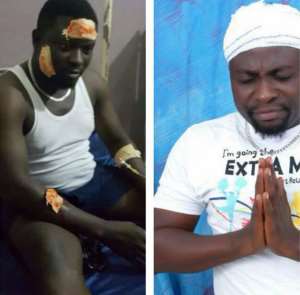 Revealed : BRO Sammy Never had an accident, he faked it - OlaWrites