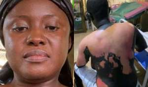 Jealous wife arrested for cooking husband with hot water