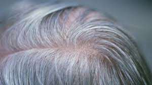 Solving A Biological Puzzle: How Stress Causes Gray Hair