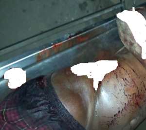 Sogakope: Assemblyman Murdered In Cold Blood; Wife Injured