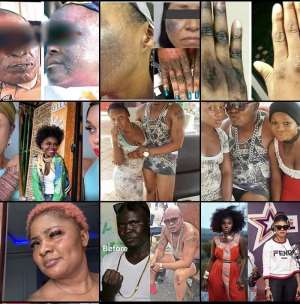 Bleaching In Muslim And Northern Communities
