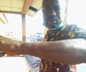 Sierra Leone journalist Alusine Antha was recently beaten while covering a meeting over a land dispute. Photo: Alusine Antha