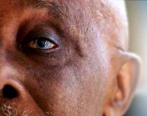 Glaucoma: 45,000 people blind in Ghana, highest in Africa