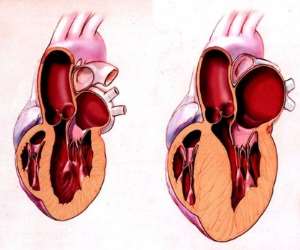 Beyond Medication: Integrative Therapies for Hypertrophic Cardiomyopathy