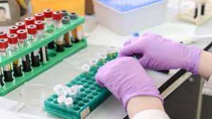 Suspected COVID-19 Patient In Damongo Test Negative