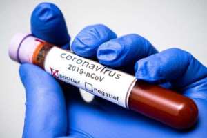 Coronavirus: People Tested Positive Advised To Avoid Pets
