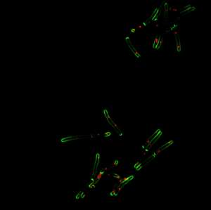 Fluorescence microscopy of mycobacteria. - Source: Michael A. Reiche, Timothy J. de Wet, Ryan Dinkele and Digby F. Warner