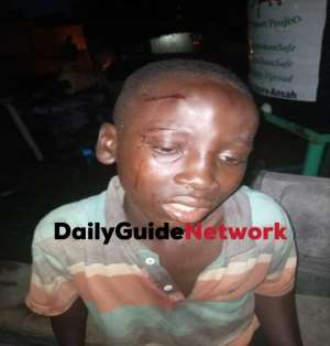 Suhum: Woman remanded for smearing stepson genitals with pepper