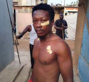 Man escapes death after multiple stabs by thiefat Tema