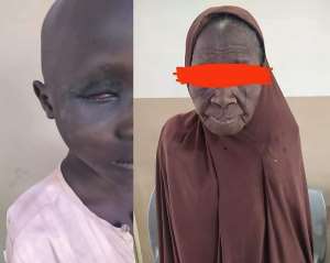 Gouging out Child's Eye Illustrates Viciousness of Ritual Beliefs