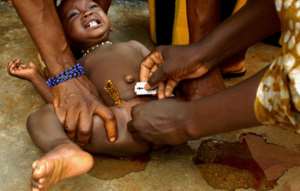 FGM, A Devastating Women Right Violation