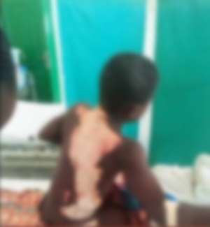 Kasoa again as angry 14-year-old boy sets 10-year-old boy ablaze at Amanfrom