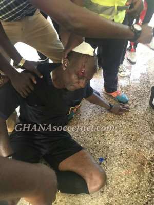 EXPOSED: Elmina Sharks In Blatant Lie Over Cause Of Injury To Referee Liman In Medeama Clash