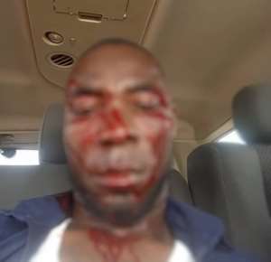 Tensions flare in Binduri as newly elected PM beaten after DCE nominee was rejected