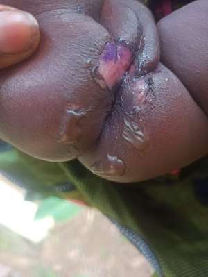 Concealment Of Crime At Mepe: Alleged Intentional Burning Of A Three-Month-Old Baby With Hot Water, An Open Letter to IGP