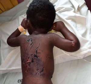 Kumasi: Dad Whip 3-Year-Old Son With Wire For Being A Financial Burden, Wetting Bed