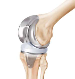 Interview with Knee Replacement Surgeon Dr. Bakul Arora by Hopeland Medical Tourism