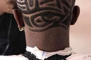 Photo: Facebook Users Troll Shatta Wale Over Skin Disease On His Neck
